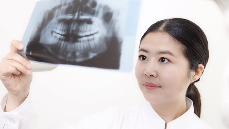半口种植牙术后，这些护理要点你get了吗？**