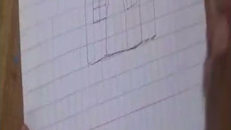 单颗种植牙，纯钛还是钛合金？材质选择背后的考量**